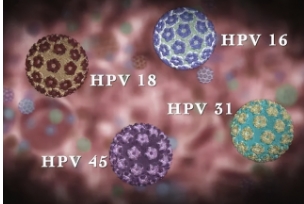 HPV最可怕的5个型号，HPV16型/18型/31型/45型/58型