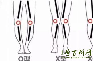 世界上最丑的腿图片，公认的4种最丑腿型(看看你是不是)
